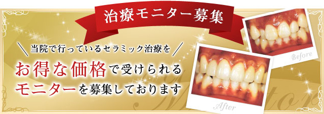 モニター募集